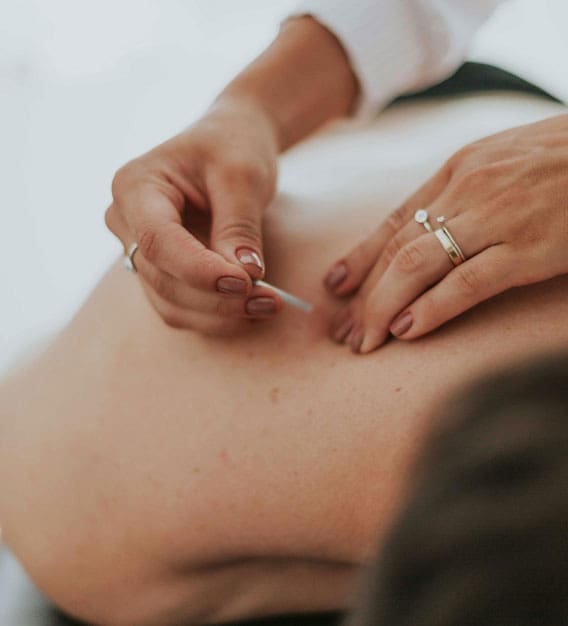 Best cold laser therapy device for acupuncturist